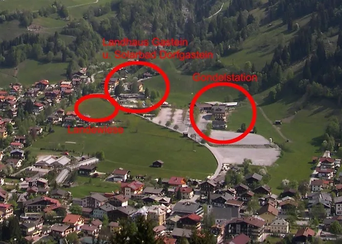 Gastein, ホテル